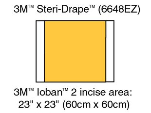 3M 6648EZ Ioban 2 Antimicrobial Incise Drapes 60cm x 60cm - Owl Medical Supplies