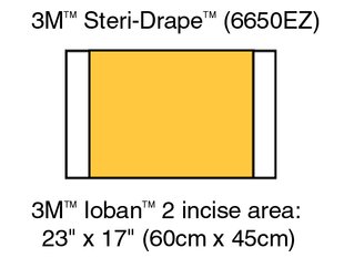 3M 6650EZ Ioban 2 Antimicrobial Incise Drapes 60cm x 45cm - Owl Medical Supplies