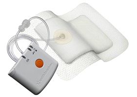 Smith & Nephew 66800958 Pico Negative Pressure Wound Therapy Kit, Single Use, Includes: Sterile Pump, (2) Ns Lithium Batteries, (2) Sterile Dressings 10" x 10", (10) Sterile Fixation Strips -