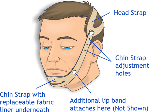 Urocare 6200 Anti-Snoring Strap. Includes: 1 Head Strap (#620001), 1 Chin Strap (#620002), 1 Lip Strap (#620004), 2 Chin Strap Liners (#620003), 4 Plastic Buttons (#603402), Illustrated Use A
