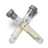 BD BD364953 Vacutainer C&S Urine Collection Kit