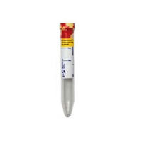 Vacutainer Urine Collection Tube