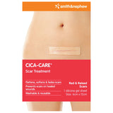 Smith & Nephew 66320703 Cica-Care Adhesive Gel Sheet 12cm x 6cm - Owl Medical Supplies