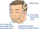 Urocare 6200 Anti-Snoring Strap. Includes: 1 Head Strap (#620001), 1 Chin Strap (#620002), 1 Lip Strap (#620004), 2 Chin Strap Liners (#620003), 4 Plastic Buttons (#603402), Illustrated Use A